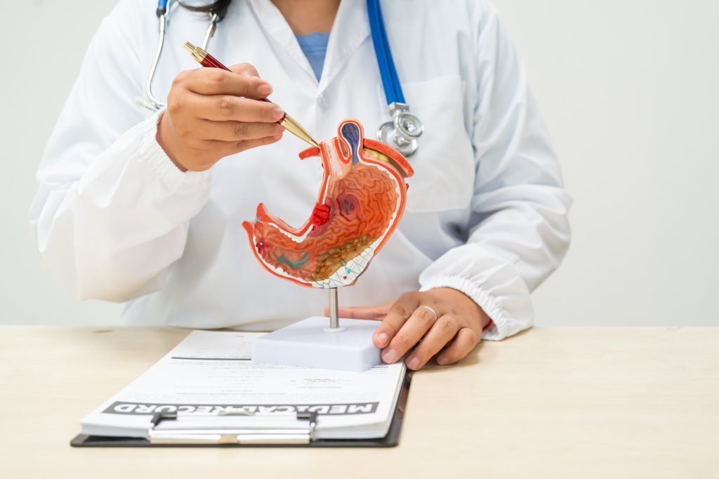 A female doctor a hospital desk discussing digestive disorders such as stomach ulcers,acid reflux