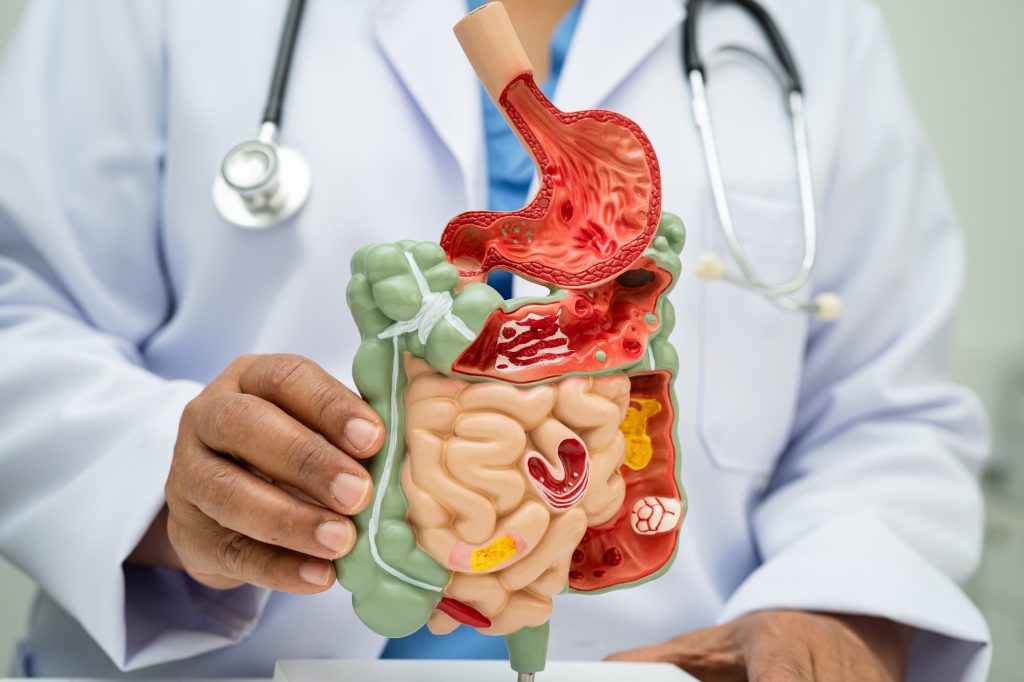 Digestive system with stomach and intestine, Asian doctor holding human anatomy model