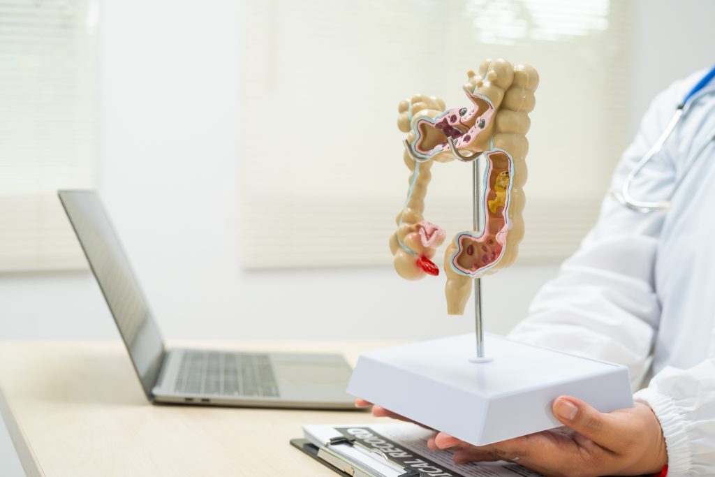 Especialista sostiene un modelo anatómico del colon en la consulta de Centro PAD