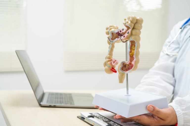Especialista sostiene un modelo anatómico del colon en la consulta de Centro PAD